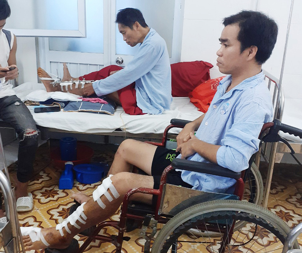 Anh Lê Văn Dùy những ngày điều trị tại Bệnh viện trung ương Huế.